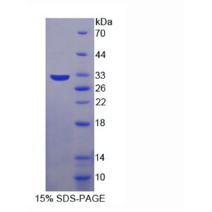 DNA激活蛋白激酶催化亞基肽(PRKDC)重組蛋白,Recombinant Protein Kinase, DNA Activated, Catalytic Polypeptide (PRKDC)