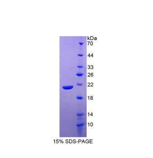 信号淋巴细胞激活分子家族成员7(SLAMF7)重组蛋白,Recombinant Signaling Lymphocytic Activation Molecule Family, Member 7 (SLAMF7)