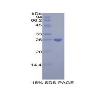 正五聚蛋白3(PTX3)重組蛋白,Recombinant Pentraxin 3, Long (PTX3)