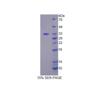 Dicer酶1(DICER1)重組蛋白,Recombinant Dicer 1, Ribonuclease Type III (DICER1)