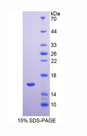 跨膜蛋白27(TMEM27)重组蛋白,Recombinant Transmembrane Protein 27 (TMEM27)