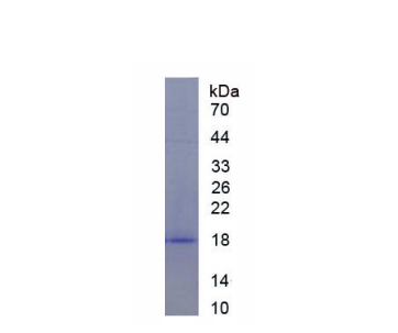 真核翻譯起始因子4E結合蛋白1(EIF4EBP1)重組蛋白,Recombinant Eukaryotic Translation Initiation Factor 4E Binding Protein 1 (EIF4EBP1)