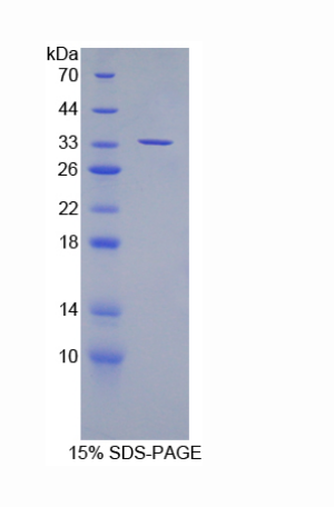 彩斑4-20同源物1抑制因子2(SUV420H2)重组蛋白,Recombinant Suppressor Of Variegation 4-20 Homolog 2 (SUV420H2)