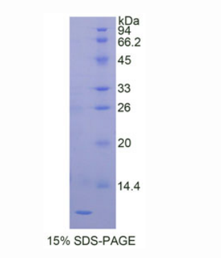 胎盘特异性蛋白9(PLAC9)重组蛋白,Recombinant Placenta Specific Protein 9 (PLAC9)