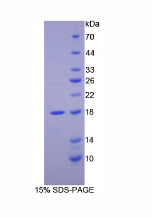 视黄醇结合蛋白2(RBP2)重组蛋白,Recombinant Retinol Binding Protein 2, Cellular (RBP2)