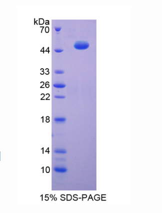 烯醇化酶(ENO3)重组蛋白,Recombinant Enolase 3 (ENO3)