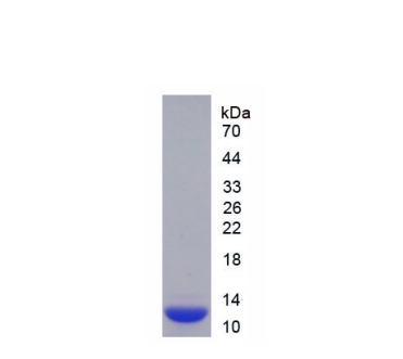 S100钙结合蛋白A10(S100A10)重组蛋白,Recombinant S100 Calcium Binding Protein A10 (S100A10)