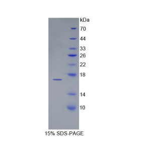 黄体激素β肽(LHb)重组蛋白,Recombinant Luteinizing Hormone Beta Polypeptide (LHb)