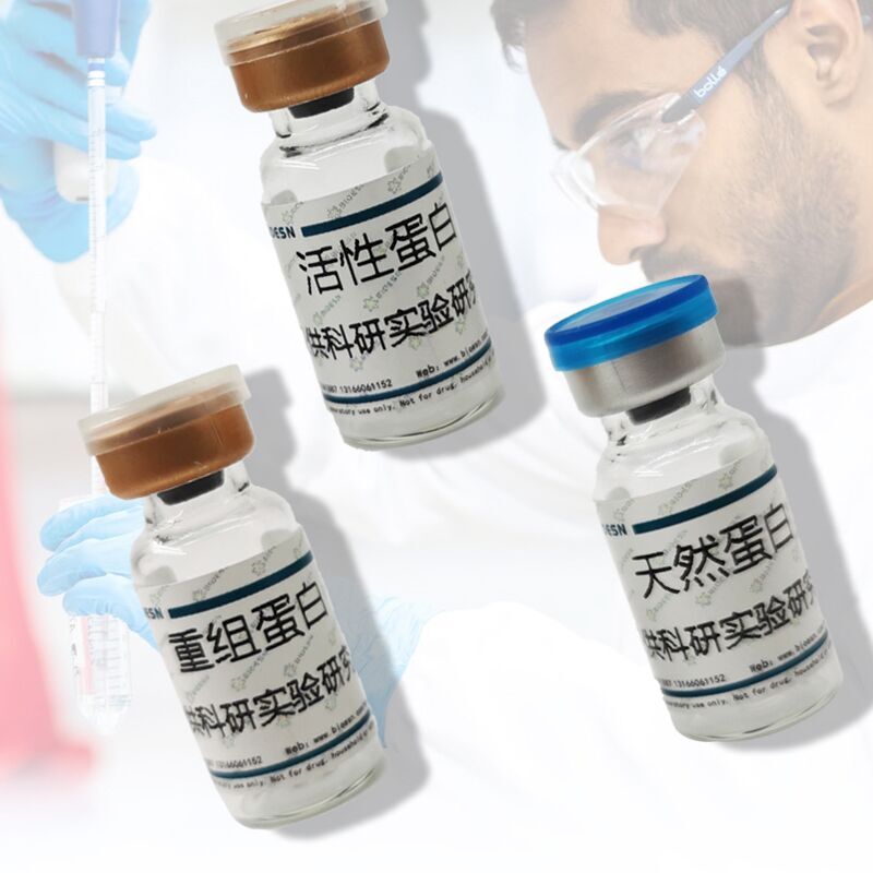 S100钙结合蛋白A16(S100A16)重组蛋白,Recombinant S100 Calcium Binding Protein A16 (S100A16)