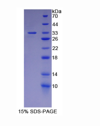 碳酸酐酶Ⅻ(CA12)重組蛋白,Recombinant Carbonic Anhydrase XII (CA12)