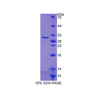 B-細(xì)胞淋巴瘤因子2樣蛋白(Bcl2L)重組蛋白,Recombinant B-Cell CLL/Lymphoma 2 Like Protein (Bcl2L)