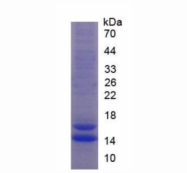 FK506结合蛋白1A(FKBP1A)重组蛋白,Recombinant FK506 Binding Protein 1A (FKBP1A)