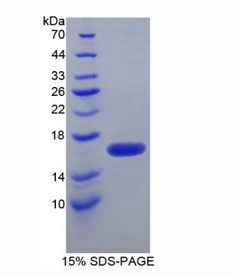 FK506结合蛋白1B(FKBP1B)重组蛋白,Recombinant FK506 Binding Protein 1B (FKBP1B)