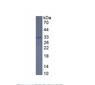 FK506結(jié)合蛋白8(FKBP8)重組蛋白,Recombinant FK506 Binding Protein 8 (FKBP8)