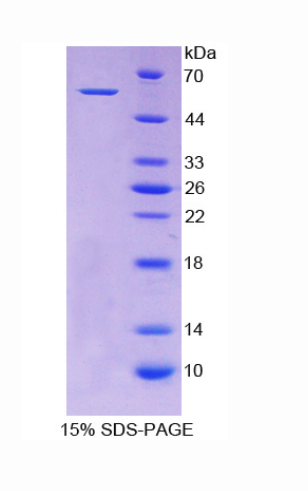 醛脱氢酶7家族成员A1(ALDH7A1)重组蛋白,Recombinant Aldehyde Dehydrogenase 7 Family, Member A1 (ALDH7A1)