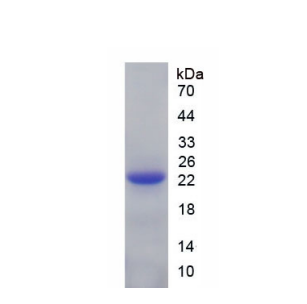 晶狀體蛋白βB2(CRYbB2)重組蛋白,Recombinant Crystallin Beta B2 (CRYbB2)