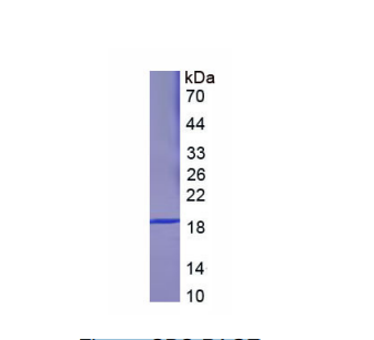 熱休克蛋白β6(HSPb6)重組蛋白,Recombinant Heat Shock Protein Beta 6 (HSPb6)