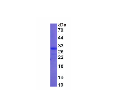 泛素羧基端酯酶L3(UCHL3)重组蛋白,Recombinant Ubiquitin Carboxyl Terminal Hydrolase L3 (UCHL3)