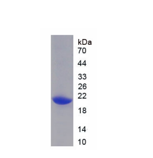 酸性核磷蛋白32A(ANP32A)重组蛋白,Recombinant Acidic Nuclear Phosphoprotein 32 Family, Member A (ANP32A)