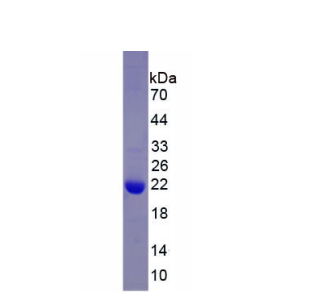 血小板反应蛋白解整合素金属肽酶2(ADAMTS2)重组蛋白,Recombinant A Disintegrin And Metalloproteinase With Thrombospondin 2 (ADAMTS2)