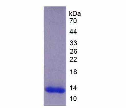 血小板反应蛋白解整合素金属肽酶8(ADAMTS8)重组蛋白,Recombinant A Disintegrin And Metalloproteinase With Thrombospondin 8 (ADAMTS8)