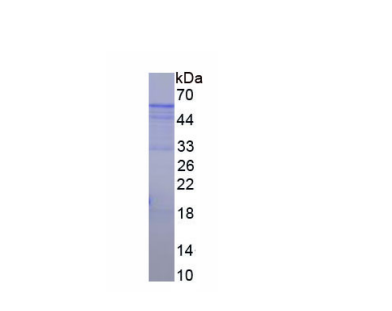 黃體激素(LH)重組蛋白,Recombinant Luteinizing Hormone (LH)