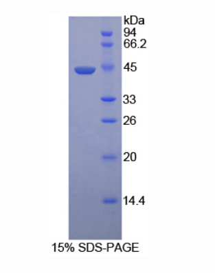 透明质酸氨基葡糖苷酶2(HYAL2)重组蛋白,Recombinant Hyaluronoglucosaminidase 2 (HYAL2)