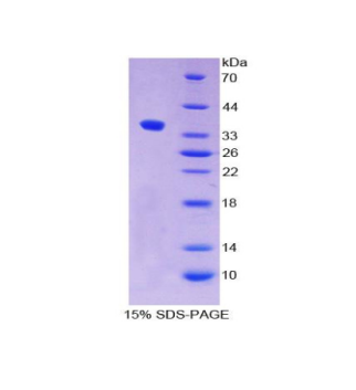 胎盘碱性磷酸酶样蛋白2(ALPPL2)重组蛋白,Recombinant Alkaline Phosphatase, Placental Like Protein 2 (ALPPL2)