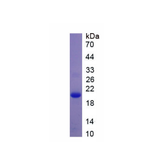 Ⅱ類主要組織相容性復合體DRα(HLA-DRA)重組蛋白,Recombinant HLA Class II Histocompatibility Antigen, DR Alpha Chain (HLA-DRA)