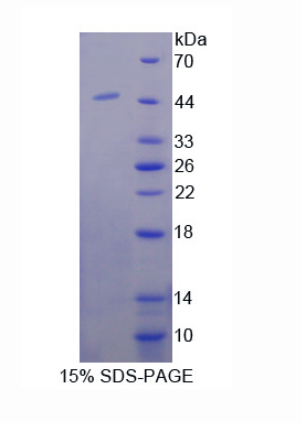 含卷曲螺旋域蛋白60(CCDC60)重组蛋白,Recombinant Coiled Coil Domain Containing Protein 60 (CCDC60)