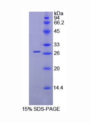 Malectin蛋白(MLEC)重组蛋白,Recombinant Malectin (MLEC)