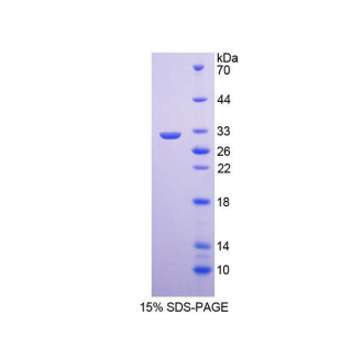 Ⅳ型胶原α5(COL4a5)重组蛋白,Recombinant Collagen Type IV Alpha 5 (COL4a5)