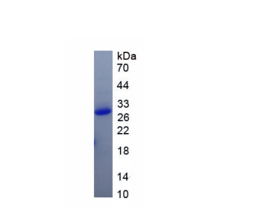 UDP-葡萄糖糖蛋白糖基转移酶2(UGGT2)重组蛋白,Recombinant UDP-Glucose Glycoprotein Glucosyltransferase 2 (UGGT2)