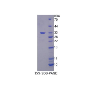 Dicer酶1(DICER1)重组蛋白