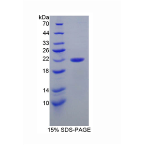 帕金森氏病蛋白7(PARK7)重组蛋白,Recombinant Parkinson Disease Protein 7 (PARK7)