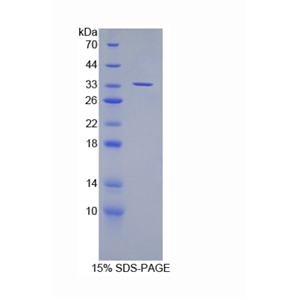 彩斑4-20同源物1抑制因子2(SUV420H2)重组蛋白
