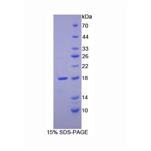 视黄醇结合蛋白2(RBP2)重组蛋白