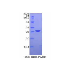 谷胱甘肽S转移酶μ1(GSTM1)重组蛋白
