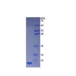 胸腺素β4(TMSB4X)重組蛋白