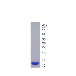 S100钙结合蛋白A10(S100A10)重组蛋白