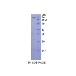 90kDa熱休克蛋白αB1(HSP90aB1)重組蛋白