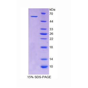 醛脱氢酶7家族成员A1(ALDH7A1)重组蛋白,Recombinant Aldehyde Dehydrogenase 7 Family, Member A1 (ALDH7A1)