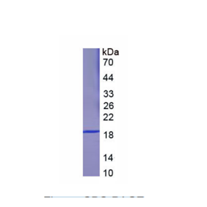 熱休克蛋白β6(HSPb6)重組蛋白,Recombinant Heat Shock Protein Beta 6 (HSPb6)