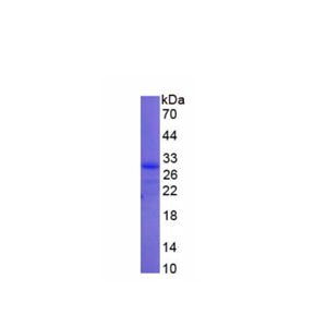 泛素羧基端酯酶L3(UCHL3)重组蛋白,Recombinant Ubiquitin Carboxyl Terminal Hydrolase L3 (UCHL3)