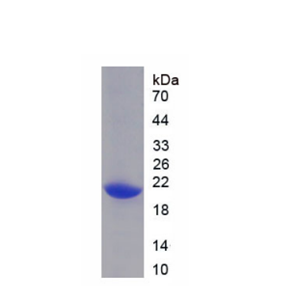 酸性核磷蛋白32A(ANP32A)重组蛋白