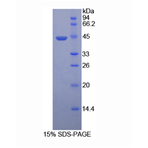 透明质酸氨基葡糖苷酶2(HYAL2)重组蛋白,Recombinant Hyaluronoglucosaminidase 2 (HYAL2)