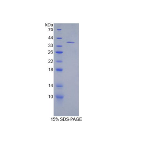 角蛋白71(KRT71)重组蛋白