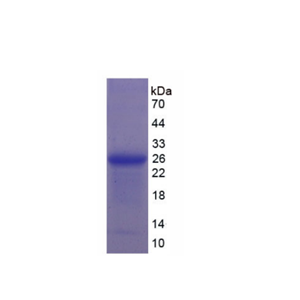 类粘蛋白2(ORM2)重组蛋白
