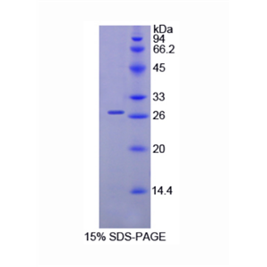 Malectin蛋白(MLEC)重组蛋白,Recombinant Malectin (MLEC)