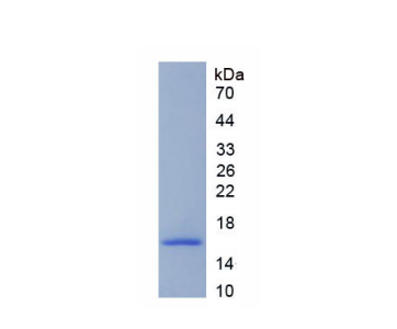 脱支酶同源物1(DBR1)重组蛋白,Recombinant Debranching Enzyme Homolog 1 (DBR1)